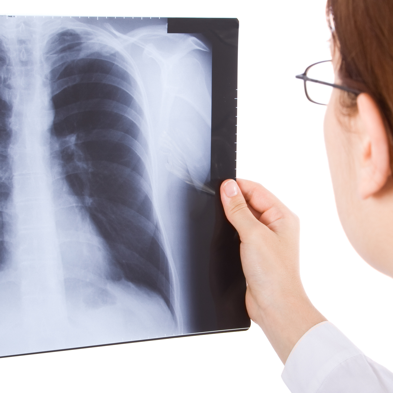 af diagnosis