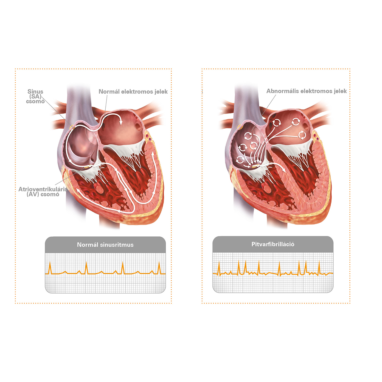 Pontosabb képet ad a budaörsi rendelő új szívultrahang-készüléke