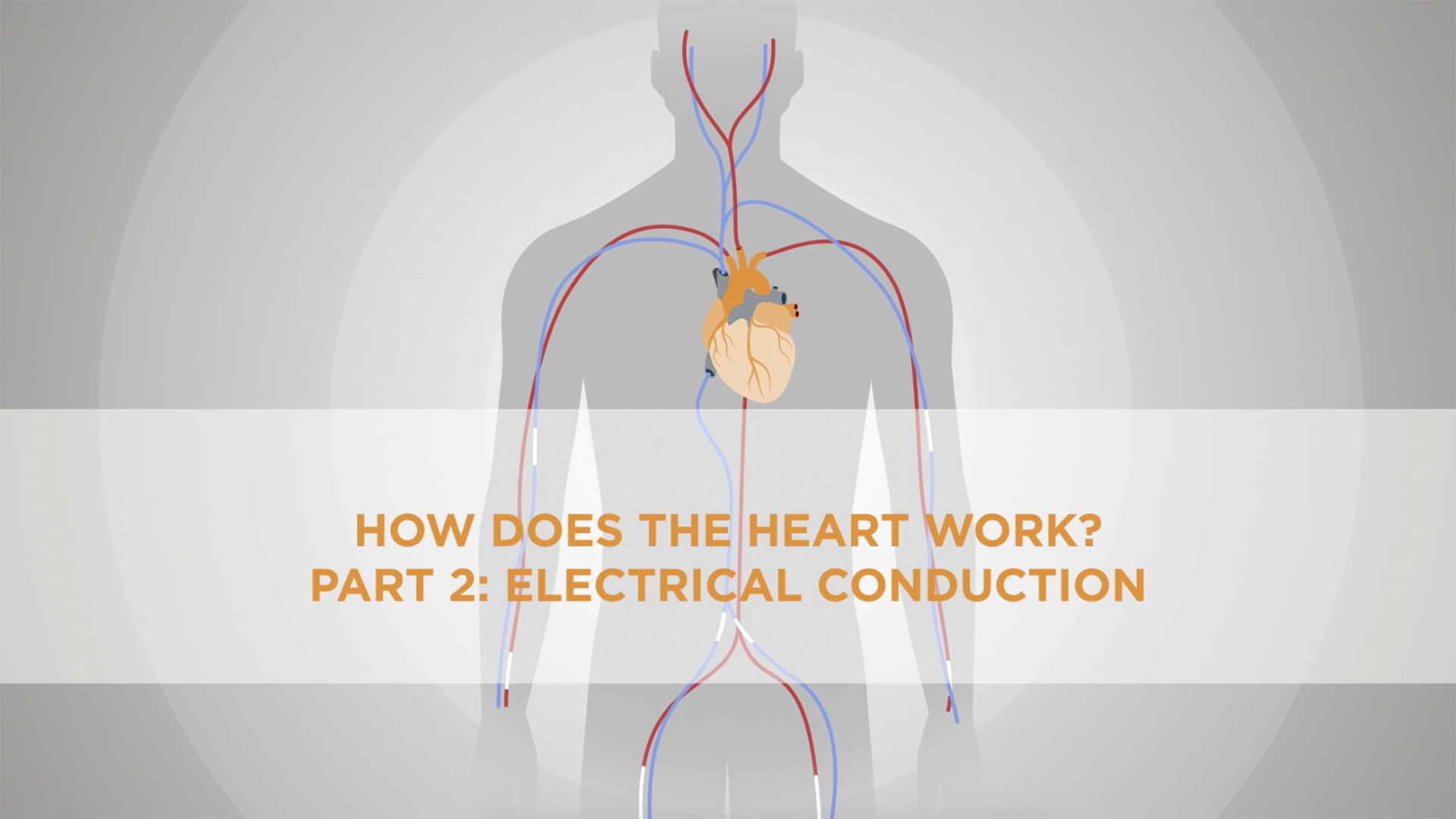 Electrical conduction